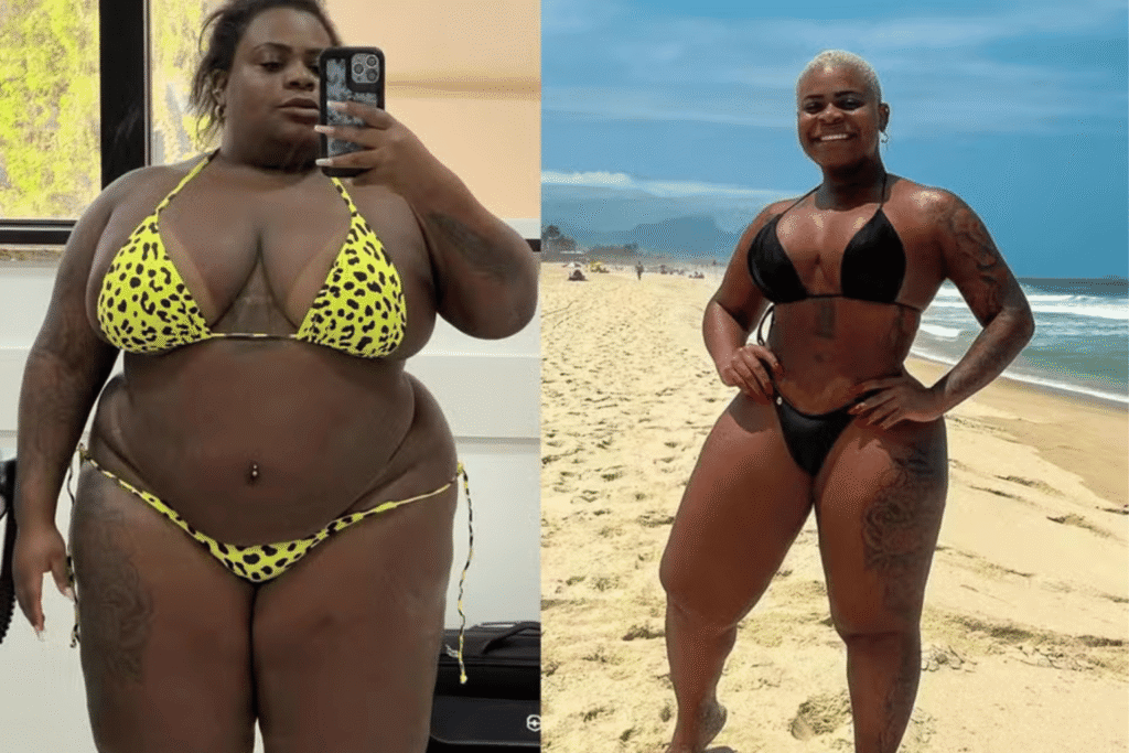 Jojo Todynho antes e depois Jojo Todynho antes e depois 1